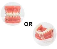 ワイヤー矯正またはマウスピース矯正の写真